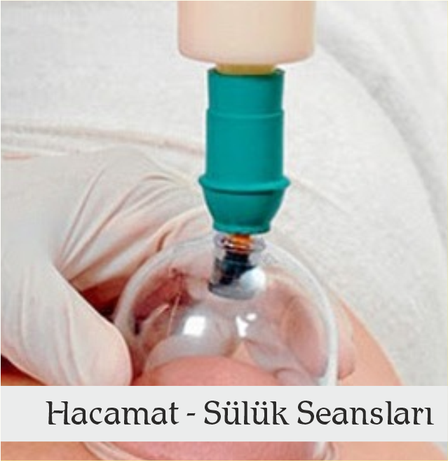 Hacamat - Sülük Uygulaması